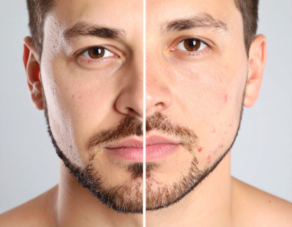 a split image: left side shows smooth, healthy skin; right side shows close—up of razor bumps and redness